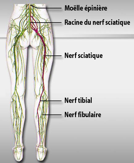 nerf-sciatique