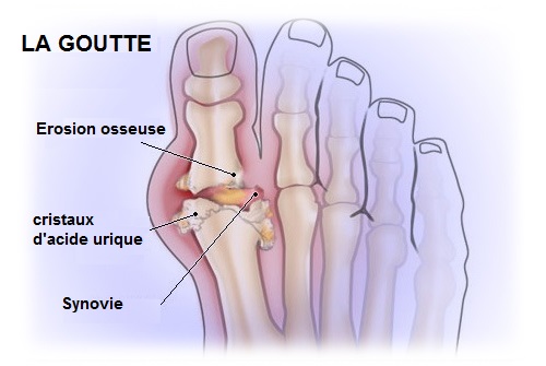 la-goutte